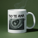 Caneca Promovido a Titio, Personalizada com Foto de Ultrassom